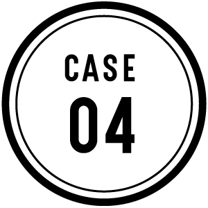 CASE 04
